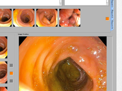 EndoPACS Screenshot 1
