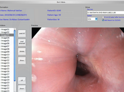 EndoPACS Screenshot 1