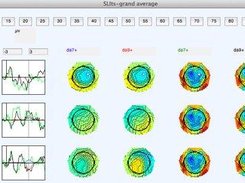 Topographic plot of PCA results