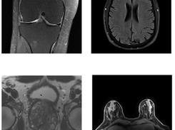 fastMRI Screenshot 1