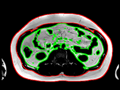 result of FATCALC segmentation