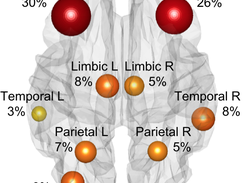 Axial view of discriminative graph for 22q11 deletion syndrome patients - vertices only (PubMed PMID 24562717)