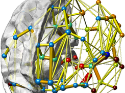 example DTI data visualisation with 1 hemisphere brain mesh