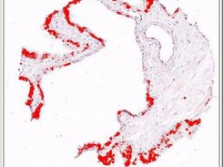 An image that has been filtered using a color mask in Frida