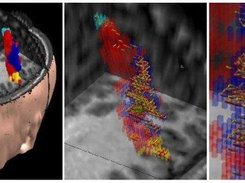 Spatial view of correlation clusters