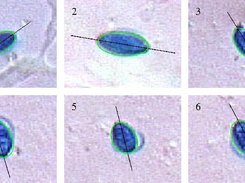 Image processing for recognition of biological particles in microscopic images, by Reinert Korsnes at Bioforsk