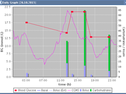 Pump Graph (with CGMS data)