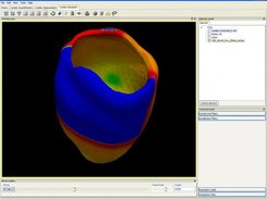 Electrical simulation of the heart