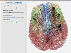 Segmented brain volume with graph in OSX 10.6