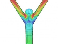 3D FEM model and CFD study of arterial wall shear stress.