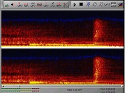 Sonogram view