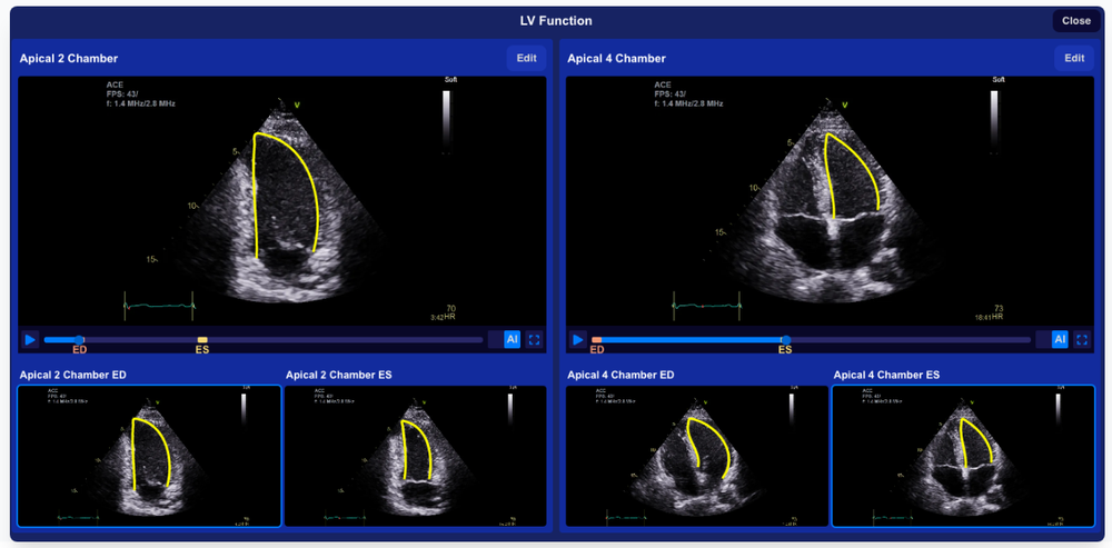 HeartLab Pulse Screenshot 1