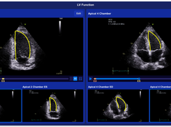 HeartLab Pulse Screenshot 1