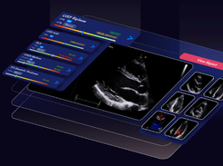 HeartLab Pulse Screenshot 1