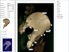 Screenshot of the digitizing window of the HIP software (iliac view).