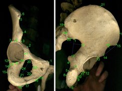 Landmarks defined on the images of the pelvic bone in the pubic view (left) and the iliac view (right).