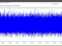 Signal plot