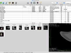 Horos DICOM Image Viewer