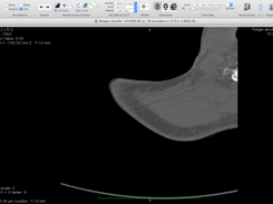 Horos DICOM Image Viewer