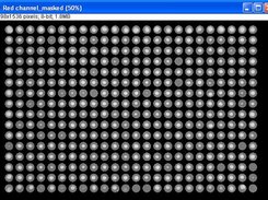 A masked image after automatic analysis.