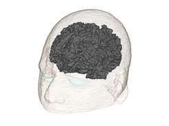 White Matter