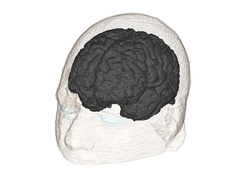 Gray Matter