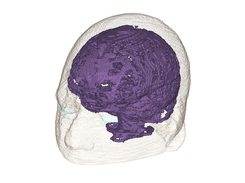 Cerebrospinal Fluid (CSF)