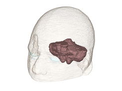 Cerebellum