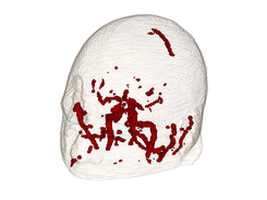 Blood