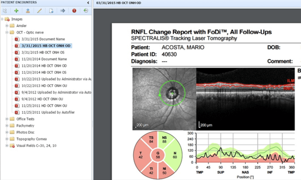 Ibeza Screenshot 1