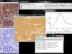 Cytoplasmic stained sample image score and the corresponding histogram profile