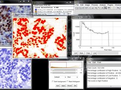 Nucleus stained sample image score and the corresponding histogram profile