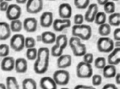 Computation of morphological gradient on blobs image