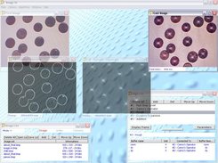 Center of circles detected by Hough Transform