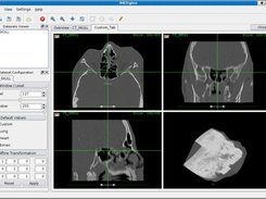Screenshot of iMEDgine showing a skull