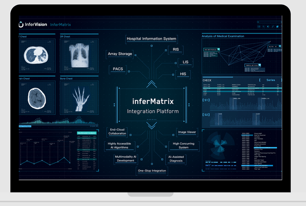 Infervision Screenshot 1