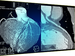 INFINITT Cardiology Suite Screenshot 1