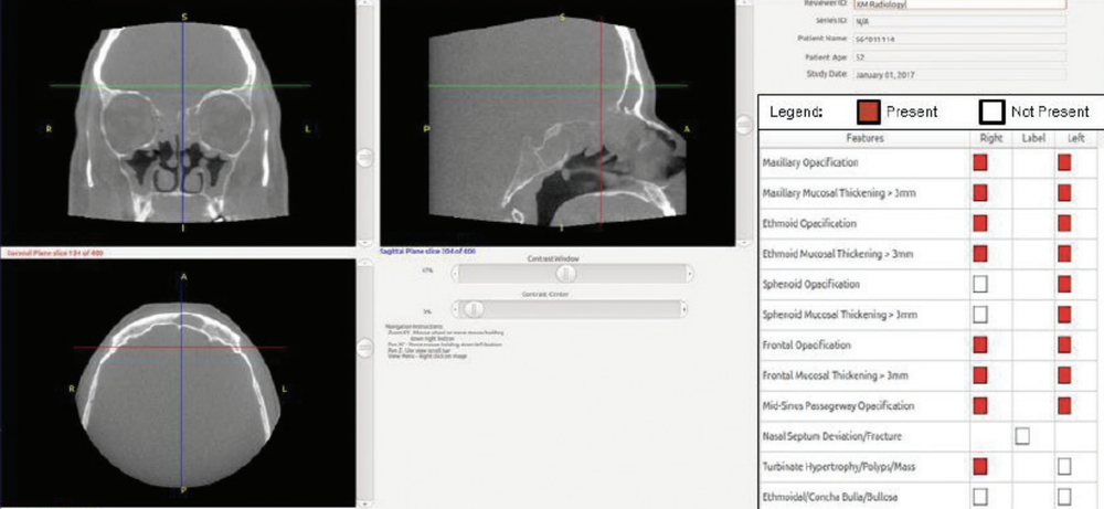 InformAI Screenshot 1