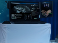 Intelligent Ultrasound Screenshot 1