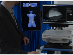 Intelligent Ultrasound Screenshot 2