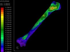 HUmero con material anisotropico