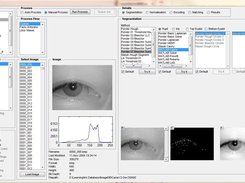 The Generic Platform For Iris Recognition