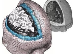 Colins human brain atlas mesh