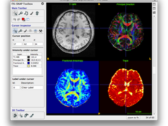 User Interface (Human Brain)