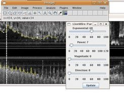 LiveWire ImageJ plugin in a longitudinal IVUS segmentation