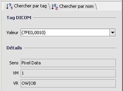 Search on Pixel Data tag (Windows XP - French) 