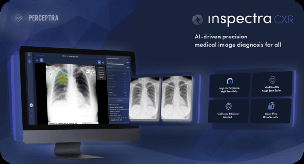 Reporting Through Inspectra CXR