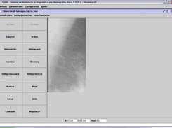 Pantalla de edicin de imagenes