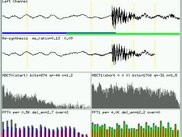 Analyzing MP3 encoding file with mp3x