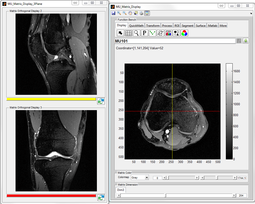 Dicomdir чем открыть снимки мрт. Программа для просмотра мрт. Программы просмотра Dicom. Dicom viewer код. Вьювер просмотра мрт.